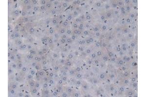 Detection of F2 in Rat Liver Tissue using Monoclonal Antibody to Coagulation Factor II (F2) (Prothrombin anticorps  (AA 201-323))