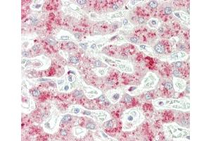 Formalin-fixed and paraffin-embedded H.