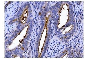 IHC analysis of CD13/ANPEP using anti-CD13/ANPEP antibody (ABIN7600088). (CD13 anticorps  (AA 148-966))