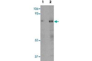 Western blot analysis of human skeletal muscle tissue with RANBP10 polyclonal antibody  at (Lane 1) 1 and (Lane 2) 2 ug/mL dilution. (RANBP10 anticorps  (Internal Region))