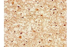 IHC image of ABIN7152369 diluted at 1:300 and staining in paraffin-embedded human brain tissue performed on a Leica BondTM system.