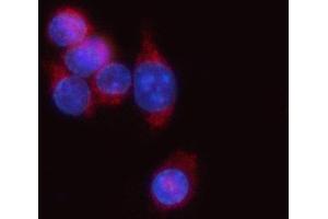 IF analysis of Tap1 using anti-Tap1 antibody (ABIN7600660).