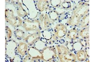 Immunohistochemistry of paraffin-embedded human kidney tissue using ABIN7147719 at dilution of 1:100 (CHD2 anticorps  (AA 1569-1828))