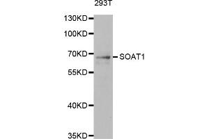 Western blot analysis of extracts of 293T cells, using SOAT1 antibody. (SOAT1 anticorps)