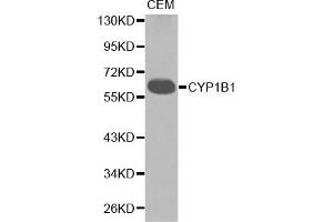 Western blot analysis of extracts of CEM cell lines, using CYP1B1 antibody. (CYP1B1 anticorps)