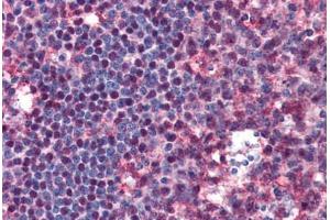 Human Tonsil: Formalin-Fixed, Paraffin-Embedded (FFPE)