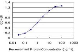 Detection limit for recombinant GST tagged OTX1 is approximately 0. (OTX1 anticorps  (AA 10-116))