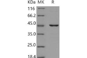 Western Blotting (WB) image for Histone Deacetylase 8 (HDAC8) protein (His tag) (ABIN7320338)