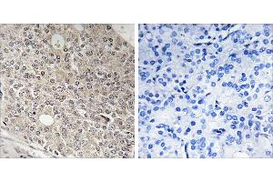 Peptide - +Immunohistochemistry analysis of paraffin-embedded human prostate carcinoma tissue using AMOTL1 antibody. (AMOTL1 anticorps)