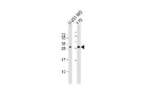 All lanes : Anti-PK1IP1L Antibody (Center) at 1:1000 dilution Lane 1: U-251 MG whole cell lysate Lane 2: Y79 whole cell lysate Lysates/proteins at 20 μg per lane. (MAPK1IP1L anticorps  (AA 108-137))