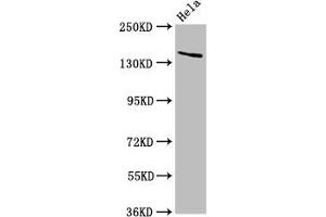 Western Blot Positive WB detected in: Hela whole cell lysate All lanes: LAMC2 antibody at 5 μg/mL Secondary Goat polyclonal to rabbit IgG at 1/50000 dilution Predicted band size: 131, 122 kDa Observed band size: 140 kDa (LAMC2 anticorps  (AA 417-588))