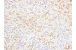Immunohistochemistry (IHC) image for anti-serine/threonine Kinase 17a (STK17A) (AA 354-414) antibody (ABIN7454849)