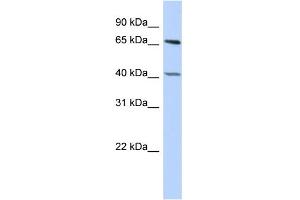 WB Suggested Anti-RBBP5 Antibody Titration:  0. (RBBP5 anticorps  (Middle Region))