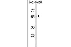 Western blot analysis in NCI-H460 cell line lysates (35ug/lane). (SIGLEC5 anticorps  (N-Term))