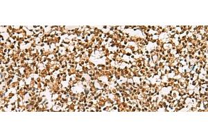 Immunohistochemistry of paraffin-embedded Human tonsil tissue using PHF5A Polyclonal Antibody at dilution of 1:55(x200)