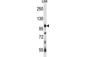 USP4 Antibody (N-term) western blot analysis in human uterine tumor tissue lysates (35 µg/lane). (USP4 anticorps  (N-Term))
