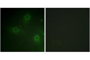 Immunofluorescence analysis of HeLa cells, using p47 phox (Ab-304) Antibody. (NCF1 anticorps  (AA 281-330))