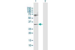 Western Blot analysis of SNF8 expression in transfected 293T cell line by SNF8 MaxPab polyclonal antibody. (SNF8 anticorps  (AA 1-258))
