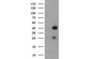 Western Blotting (WB) image for anti-alpha-1,4-N-Acetylglucosaminyltransferase (A4GNT) (AA 121-340) antibody (ABIN2715585)