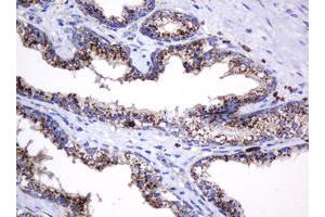 Image no. 8 for anti-Galactosidase, beta 1 (GLB1) antibody (ABIN1498467)