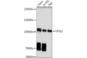 Western blot analysis of extracts of various cell lines, using VPS11 Rabbit mAb (ABIN7271272) at 1:1000 dilution.