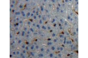 IHC-P analysis of liver tissue, with DAB staining. (CPB2 anticorps  (AA 309-374))