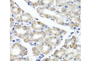 Immunohistochemistry of paraffin-embedded Human stomach using MAPKBP1 Polyclonal Antibody at dilution of 1:100 (40x lens). (MAPKBP1 anticorps)