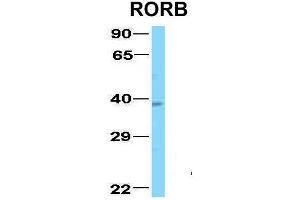 Host:  Rabbit  Target Name:  RORB  Sample Type:  Human Fetal Lung  Antibody Dilution:  1. (RORB anticorps  (C-Term))