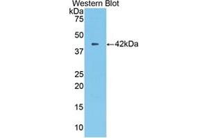 Western blot analysis of the recombinant protein. (CPB2 anticorps  (AA 113-422))