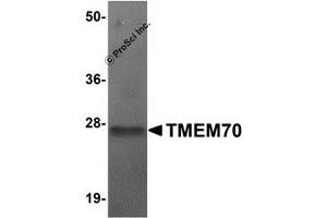 Western Blotting (WB) image for anti-Transmembrane Protein 70 (TMM70) (Middle Region) antibody (ABIN1031136) (Transmembrane Protein 70 (TMM70) (Middle Region) anticorps)