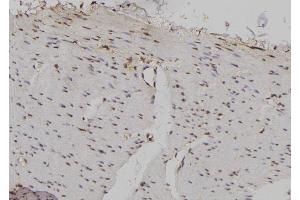 ABIN6276998 at 1/100 staining Human gastric tissue by IHC-P.