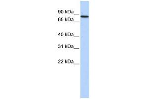 WB Suggested Anti-ADARB2 Antibody Titration:  0. (ADARB2 anticorps  (Middle Region))
