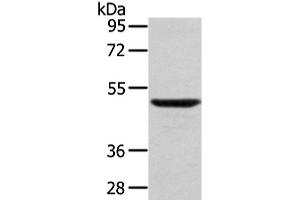 Western Blot analysis of Mouse lung tissue using WASF2 Polyclonal Antibody at dilution of 1/200 (WASF2 anticorps)