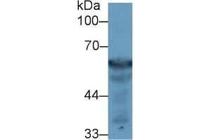 Detection of FGB in Rat Liver lysate using Polyclonal Antibody to Fibrinogen Beta Chain (FGB) (Fibrinogen beta Chain anticorps  (AA 49-495))