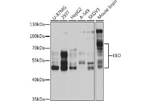 Western blot analysis of extracts of various cell lines, using EED antibody (ABIN6127866, ABIN6139942, ABIN6139945 and ABIN6221014) at 1:1000 dilution. (EED anticorps  (AA 1-300))