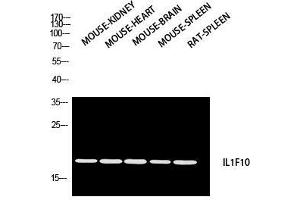 Western Blot (WB) analysis of Mouse Kidney Mouse Heart Mouse Brain Mouse Spleen Rat SPLEEN using IL1F10 antibody. (IL1F10 anticorps)