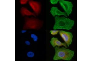 ABIN6258396 and ABIN6274461 staining Hela cells(45 min of heat-shock) by IF/ICC. (MAP4K1 anticorps  (Internal Region))