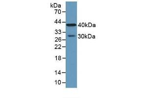 Detection of CPA4 in Human Lung Tissue using Polyclonal Antibody to Carboxypeptidase A4 (CPA4) (CPA4 anticorps  (AA 55-421))