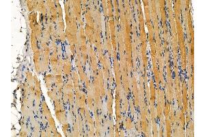 ABIN7095294 and ABIN7099351 at 1/100 staining rat muscle tissue by IHC-P. (CRYbA4 anticorps)