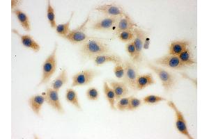 IHC analysis of FASN using anti-FASN antibody .
