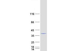 Validation with Western Blot