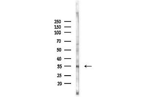 Western blot analysis of lysates from PC12 cells(LPS, 4h treatment), using Renin receptor Antibody at 1/1000 dilution.
