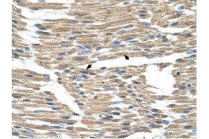 GPR177 antibody was used for immunohistochemistry at a concentration of 4-8 ug/ml to stain Skeletal muscle cells (arrows) in Human Muscle. (GPR177/WLS anticorps  (N-Term))