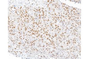 Immunohistochemistry (IHC) image for anti-Forkhead Box P1 (FOXP1) (AA 627-677) antibody (ABIN7454010)