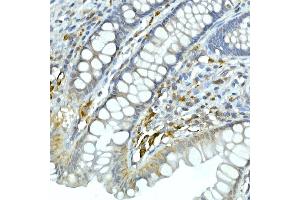 anti-Cyclin-Dependent Kinase 1 (CDK1) antibody