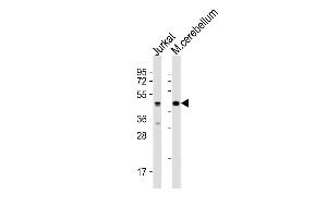 All lanes : Anti-GLUL Antibody (N-term) at 1:2000 dilution Lane 1: Jurkat whole cell lysates Lane 2: mouse cerebellum lysates Lysates/proteins at 20 μg per lane.