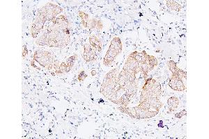 IHC analysis of PDCD6IP using anti-PDCD6IP antibody (ABIN7600490). (ALIX anticorps  (AA 2-330))