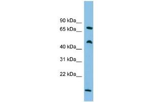 WB Suggested Anti-ECD Antibody Titration: 0. (ECD/SGT1 anticorps  (Middle Region))