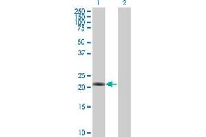 Western Blot analysis of PSMB3 expression in transfected 293T cell line by PSMB3 MaxPab polyclonal antibody. (PSMB3 anticorps  (AA 1-205))