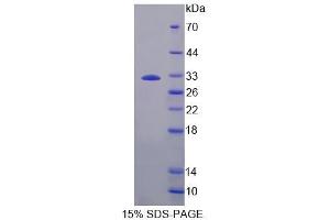 SDS-PAGE analysis of Rat PLCb2 Protein. (Phospholipase C beta 2 Protéine)